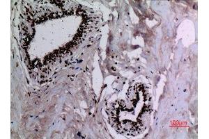 Immunohistochemistry (IHC) analysis of paraffin-embedded Human Breast, antibody was diluted at 1:100.