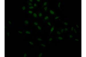 Immunofluorescence staining of Hela Cells with ABIN7127542 at 1:50, counter-stained with DAPI.