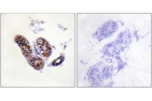 Immunohistochemistry analysis of paraffin-embedded human skin tissue, using MITF (Ab-180/73) Antibody.