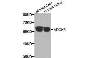 Western blot analysis of extracts of various cell lines, using ADCK3 antibody (ABIN5975514) at 1/1000 dilution. (COQ8A anticorps)
