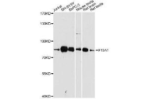 Western blot analysis of extracts of various cell lines, using F13A1 antibody. (F13A1 anticorps  (AA 600-732))