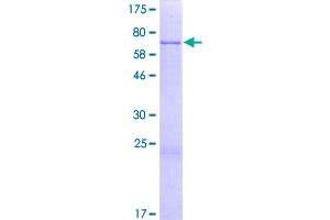 Image no. 1 for Paroxysmal Nonkinesigenic Dyskinesia (PNKD) (AA 1-385) protein (GST tag) (ABIN1315549)