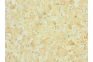 Immunohistochemistry of paraffin-embedded human liver tissue using ABIN7161008 at dilution of 1:100 (NOX3 anticorps  (AA 223-395))