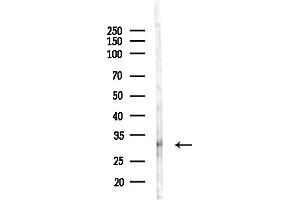 Western blot analysis of lysates from PC12 cells(LPS,4h treatment), using OR2 Antibody at 1/1000 dilution.