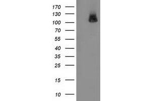 Western Blotting (WB) image for anti-phosphodiesterase 2A, CGMP-Stimulated (PDE2A) antibody (ABIN1500080) (PDE2A anticorps)