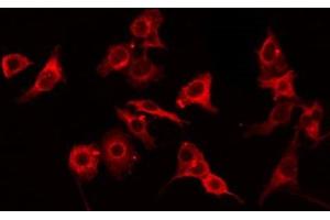 ABIN6275062 staining HT29 by IF/ICC. (GNPAT anticorps  (Internal Region))