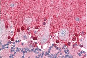 ABIN184640 (3. (ABTB1 anticorps  (C-Term))