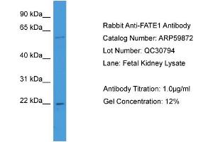 WB Suggested Anti-FATE1  Antibody Titration: 0. (FATE1 anticorps  (N-Term))