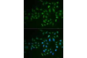 Immunofluorescence analysis of U2OS cells using MYLK3 antibody (ABIN6129615, ABIN6144266, ABIN6144267 and ABIN6222364). (MYLK3 anticorps  (AA 1-240))