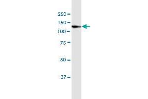 VCL monoclonal antibody (M02), clone 3F8-1D4.