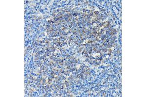 Immunohistochemistry of paraffin-embedded Mouse spleen using Alpha-tubulin (ubiquitous) chain antibody (ABIN7271033) at dilution of 1:50 (40x lens). (TUBA1B anticorps  (AA 1-451))