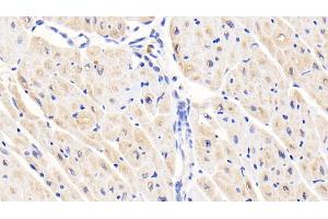 Detection of ACVR1 in Human Cardiac Muscle Tissue using Polyclonal Antibody to Activin A Receptor Type I (ACVR1)
