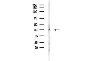 anti-RAD51 Homolog D (RAD51D) (C-Term) antibody