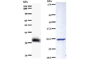 Left: YEATS4 staining. (GAS41 anticorps)