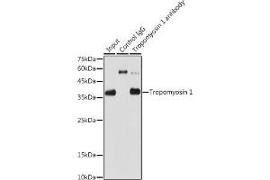 Immunoprecipitation analysis of 600 μg extracts of Rat heart cells using 3 μg Tropomyosin 1 antibody (ABIN7271013).