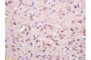 Formalin-fixed and paraffin embedded rat brain labeled with Rabbit Anti HSP10/CPN10 Polyclonal Antibody, Unconjugated (ABIN721885) at 1:200 followed by conjugation to the secondary antibody and DAB staining (HSPE1 anticorps  (AA 51-102))