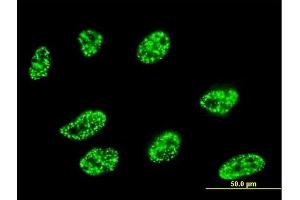 Immunofluorescence of monoclonal antibody to DLL1 on HeLa cell. (DLL1 anticorps  (AA 18-109))