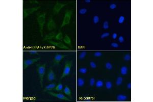 ABIN5539777 Immunofluorescence analysis of paraformaldehyde fixed HeLa cells, permeabilized with 0.