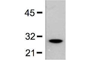1:5000 (0. (GST anticorps)