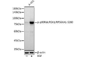 Western blot analysis of extracts of A-431 cells, using Phospho-p90Rsk/RSK1/RPS6K-S380 antibody (ABIN7270036) at 1:1000 dilution. (RPS6KA1 anticorps  (pSer380))