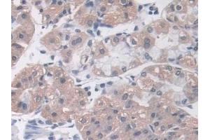 Detection of MOSC1 in Human Stomach Tissue using Polyclonal Antibody to MOCO Sulphurase C-Terminal Domain Containing Protein 1 (MOSC1) (MOSC1 anticorps  (AA 41-335))
