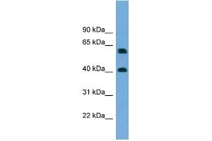 WB Suggested Anti-TERF2IP Antibody Titration: 0.