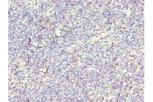 Immunohistochemistry of paraffin-embedded human thymus tissue using ABIN7169003 at dilution of 1:100 (STK38L anticorps  (AA 212-464))