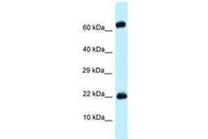 Image no. 1 for anti-Zinc Finger Protein 580 (ZNF580) (AA 58-107) antibody (ABIN6748023) (ZNF580 anticorps  (AA 58-107))