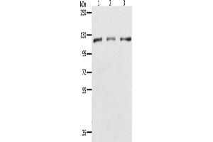 Western Blotting (WB) image for anti-Poly (ADP-Ribose) Polymerase 1 (PARP1) antibody (ABIN2432195) (PARP1 anticorps)