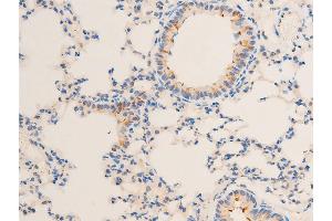ABIN6267218 at 1/100 staining mouse lung tissue sections by IHC-P.