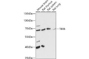 Western blot analysis of extracts of various cell lines, using TBX6 antibody (ABIN7270702) at 1:1000 dilution. (T-Box 6 anticorps  (AA 191-300))