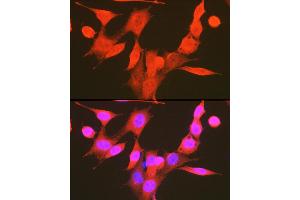 Immunofluorescence analysis of NIH-3T3 cells using Phospho-PDK1/PDPK1-S241 Rabbit pAb (ABIN6135282, ABIN6136186, ABIN6136187 and ABIN6225525) at dilution of 1:100 (40x lens). (PDPK1 anticorps  (pSer241))