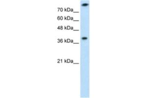 Western Blotting (WB) image for anti-Thiosulfate Sulfurtransferase (Rhodanese) (TST) antibody (ABIN2462532) (TST anticorps)