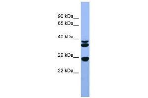 WB Suggested Anti-Fgf3 Antibody Titration:  0.
