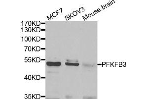 Western blot analysis of extracts of various cell lines, using PFKFB3 antibody (ABIN5974173) at 1/1000 dilution. (PFKFB3 anticorps)