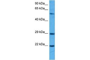 Host:  Mouse  Target Name:  SOCS1  Sample Tissue:  Mouse Pancreas  Antibody Dilution:  1ug/ml