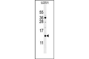 Western blot analysis using SFT2D2 Antibody (N-term) Cat. (SFT2D2 anticorps  (N-Term))