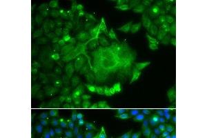 Immunofluorescence analysis of A549 cells using CACNG4 Polyclonal Antibody (CACNG4 anticorps)