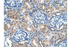 SOD1 antibody was used for immunohistochemistry at a concentration of 4-8 ug/ml. (SOD1 anticorps  (N-Term))