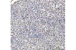 IHC analysis of ARID1A using anti-ARID1A antibody (ABIN7602567). (ARID1A anticorps  (AA 857-1552))