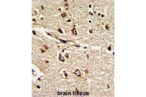 Immunohistochemistry (IHC) image for anti-Protein Disulfide Isomerase Family A, Member 6 (PDIA6) antibody (ABIN3002737)