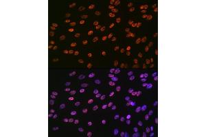 Immunofluorescence analysis of C6 cells using SMC1 Rabbit mAb (ABIN7270614) at dilution of 1:100 (40x lens). (SMC1A anticorps)