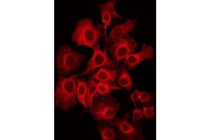 ABIN6272392 staining NIH-3T3 by IF/ICC. (PIPOX anticorps  (Internal Region))
