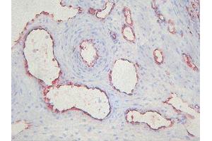 Immunohistochemistry (IHC) image for anti-Endothelial Cells antibody (ABIN781798) (Endothelial Cells anticorps)