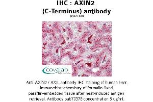 Image no. 1 for anti-Axin 2 (AXIN2) antibody (ABIN1732157) (AXIN2 anticorps)