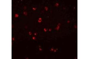 Immunofluorescencent staining of Jurkat cells with NLRC3 polyclonal antibody  at 20 ug/mL. (NLRC3 anticorps  (Internal Region))