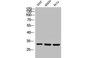 Western Blot analysis of 293T HELA using Carbonyl Reductase 1 Polyclonal Antibody. (CBR1 anticorps  (Internal Region))