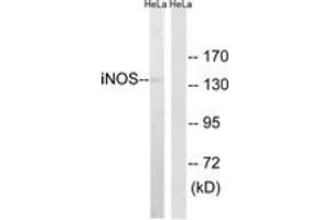 Western blot analysis of extracts from HeLa cells, using iNOS Antibody. (NOS2 anticorps  (AA 1101-1150))