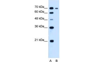 Western Blotting (WB) image for anti-Ribonucleotide Reductase M1 (RRM1) antibody (ABIN2462920) (RRM1 anticorps)