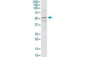 ACADM MaxPab rabbit polyclonal antibody. (Medium-Chain Specific Acyl-CoA Dehydrogenase, Mitochondrial (MCAD) (AA 1-421) anticorps)